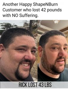 Before and After Weight Loss Picture